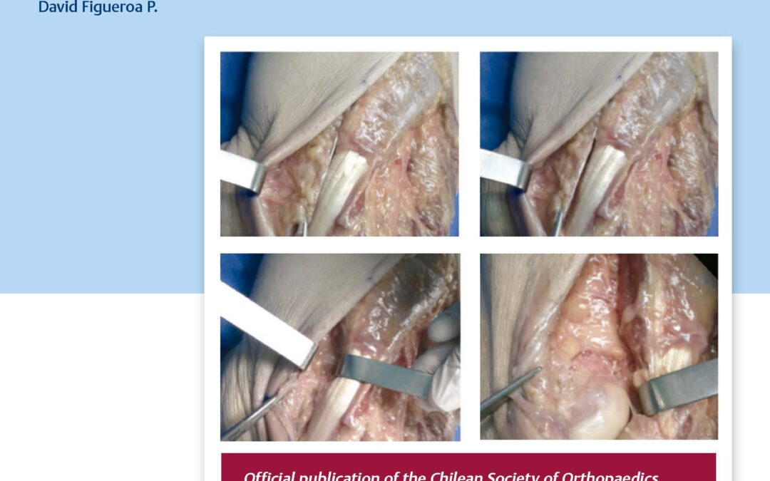 Thieme
                    
                
            
        Revista Chilena de Ortopedia e Traumatologia (RCHOT)