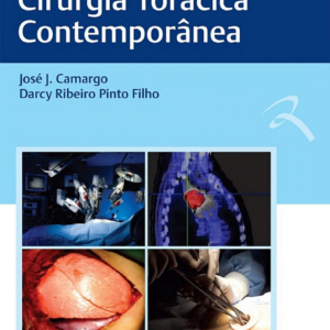 Cirurgia Torácica Contemporânea
