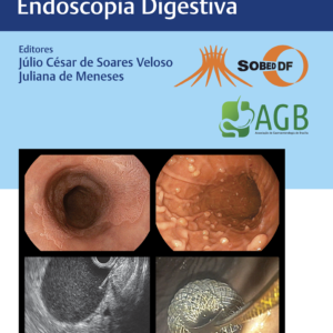 Sobed Desafios em Gastroenterologia e Endoscopia Digestiva