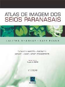 Atlas de Imagem dos Seios Paranasais