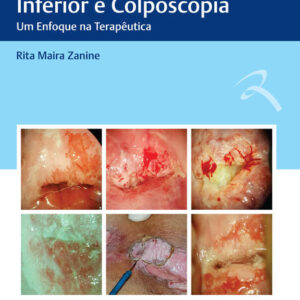 Doencas do Trato Genital Inferior e Colposcopia