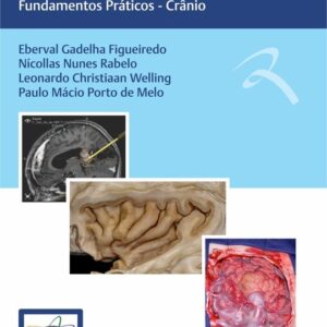 Condutas em Neurocirurgia: Fundamentos Práticos - Crânio