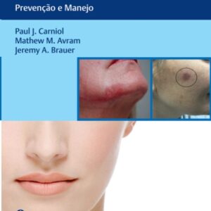 Complicações em Rejuvenescimento Facial Minimamente Invasivo