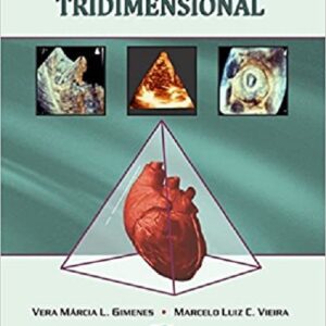 Ecocardiografia Tridimensional
