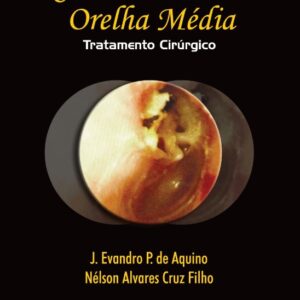 Colesteatoma da Orelha Média