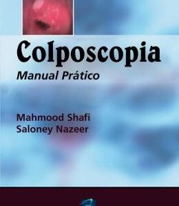 Colposcopia