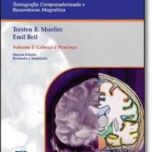 Atlas de Bolso de Anatomia Seccional - Tomografia Computadorizada e Ressonância Magnética