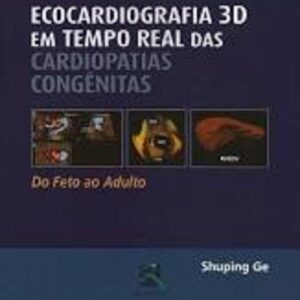 Ecocardiografia 3d em Tempo Real das Cardiopatias Congênitas