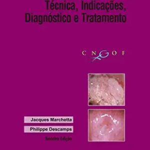 Colposcopia