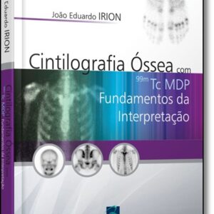 Cintilografia óssea com 99m Tc Mdp