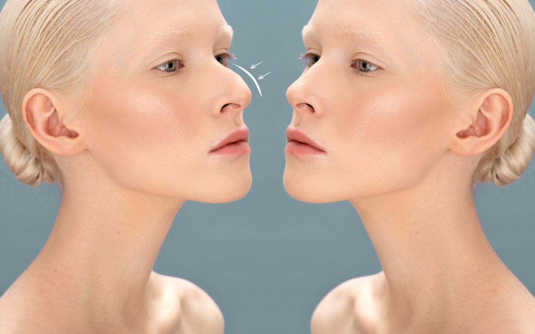 Conheça 3 guias incríveis para Cirurgia Plástica e Estética