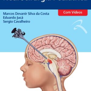 Tratado de Neurocirurgia Pediátrica