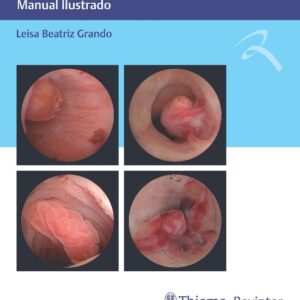Histeroscopia: Manual Ilustrado