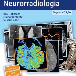 Radcases Plus Q&a Neurorradiologia