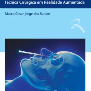 Cirurgia Endoscópica do Seio Frontal