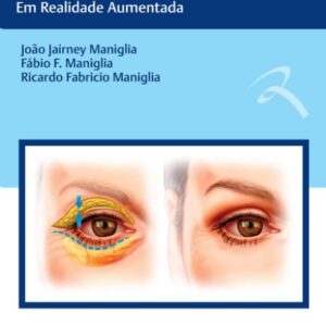 Blefaroplastia em Realidade Aumentada