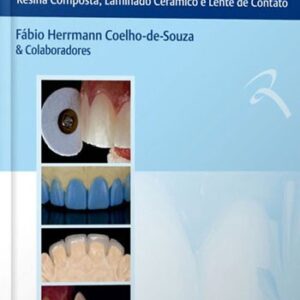 Facetas Estéticas – Resina Composta, Laminado Cerâmico e Lente de Contato