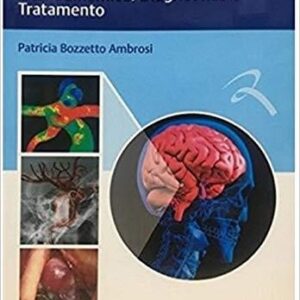Aneurismas Cerebrais