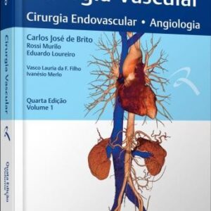 Cirurgia Vascular