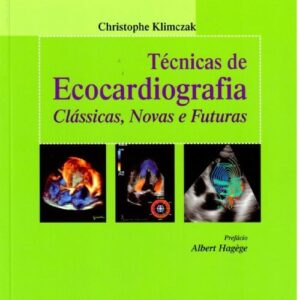 Técnicas de Ecocardiografia