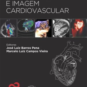 Ecocardiografia