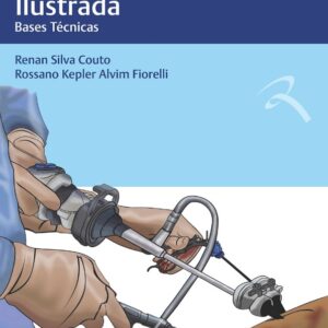 Cirurgia Laparoscópica Ilustrada