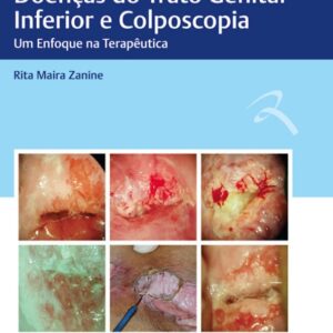 Doenças do Trato Genital Inferior e Colposcopia