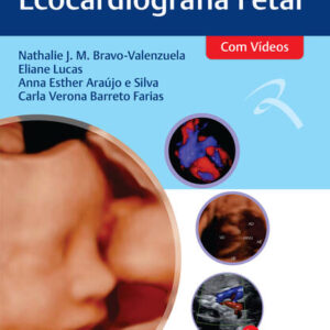 Atlas de Ecocardiografia Fetal