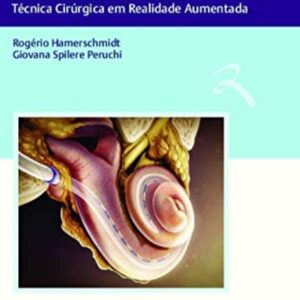 Implante Coclear