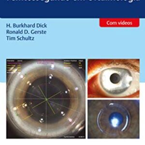 Cirurgia a Laser de Femtossegundo em Oftalmologia