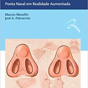 Rinoplastia