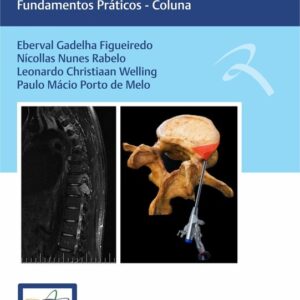Sbn Condutas em Neurocirurgia - Coluna