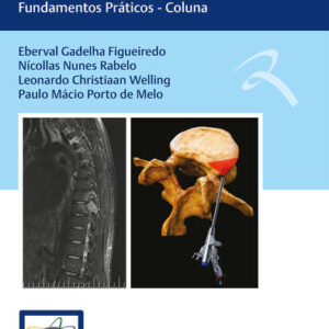 Condutas em Neurocirurgia: Fundamentos Práticos - Coluna