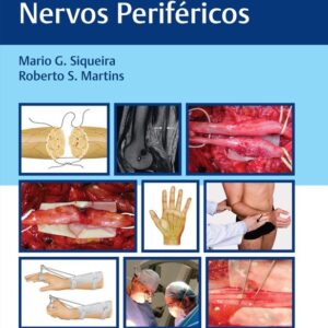 Lesões Traumáticas de Nervos Periféricos