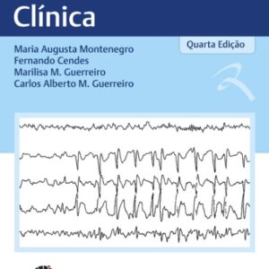 Unicamp Eeg na Prática Clínica