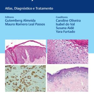 Doenças da Vulva