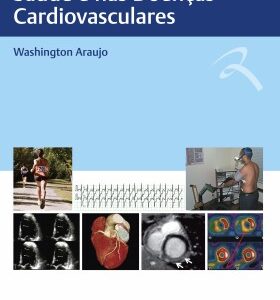 Exercício Físico na Saúde e Nas Doenças Cardiovasculares