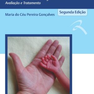 Prematuridade