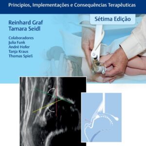 Ultrassonografia do Quadril Infantil