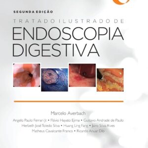 Sobed Tratado Ilustrado de Endoscopia Digestiva