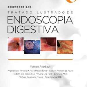 Sobed Tratado Ilustrado de Endoscopia Digestiva
