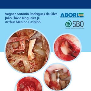 Manual Prático de Cirurgia Endoscópica de Ouvido
