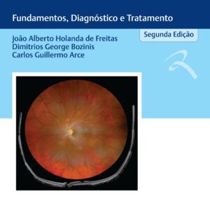 Laser - Fundamentos, Diagnóstico e Tratamento