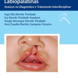 Tratado de Fissuras Labiopalatinas- Avanços no Diag.e Trat.interdisciplinar