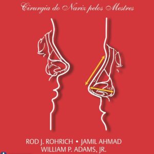 Dallas Rinoplastia - Cirurgia do Nariz Pelos Mestres.