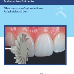 Ciência e Arte em Restaurações de Resina Composta - Acabamento e Polimento