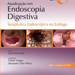 Sobed Atualização em Endoscopia Digestiva - Volume 2