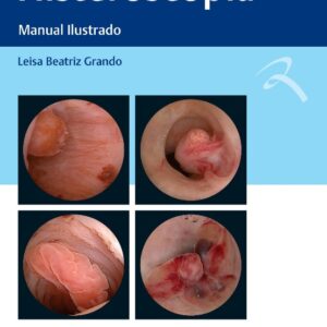 Histeroscopia: Manual Ilustrado