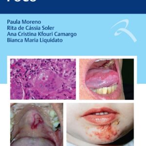 Estomatologia em Foco