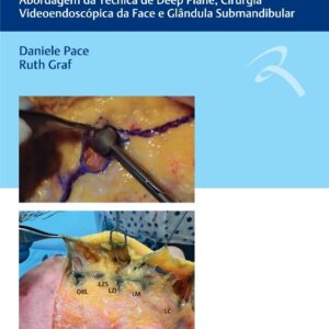 Guia Dissecção Anatômica em Cadáveres Frescos C/foco em Cirurgia da Face